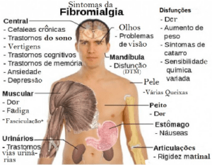 Fibromialgia Tratamento Psicológico SP